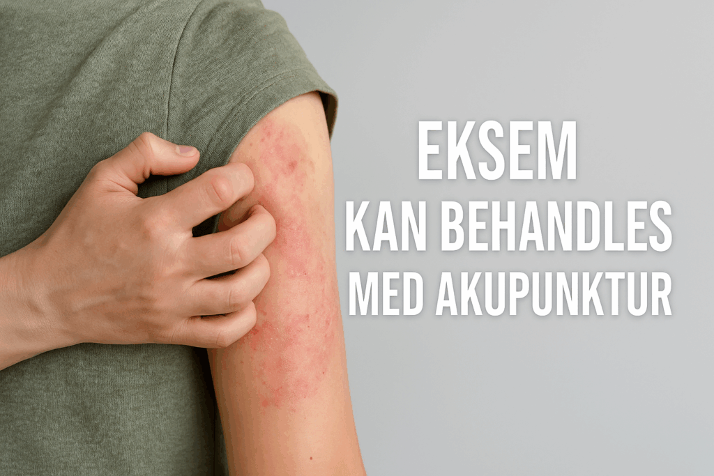 Eksem på en persons arm med rød og irriteret hud – akupunktur som mulig behandling.