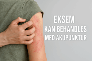 Eksem på en persons arm med rød og irriteret hud – akupunktur som mulig behandling.