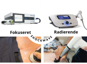 Fokuseret og radierende shockwave behandling hos AkuZoMa i Næstved og Menstrup